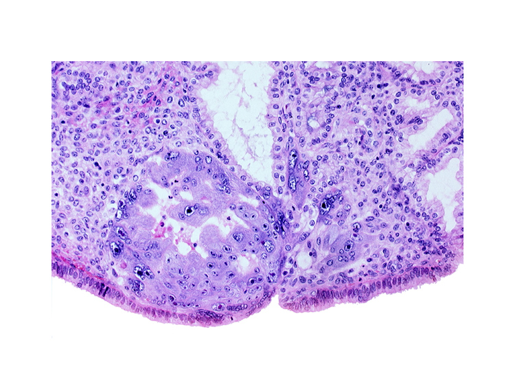 chorionic cavity, endometrial epithelium, lumen of endometrial gland, syncytiotrophoblast