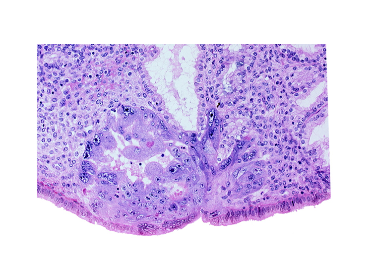 edematous endometrial stroma (decidua), endometrial epithelium, lumen of endometrial gland, maternal blood cells in intercommunicating lacunae, primary umbilical vesicle cavity, syncytiotrophoblast