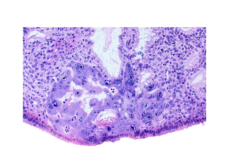 endometrial epithelium, endometrial stroma (decidua), intercommunicating lacunae, lumen of endometrial gland, maternal blood cells in primary umbilical vesicle cavity, previllus clump of cytotrophoblast, syncytiotrophoblast