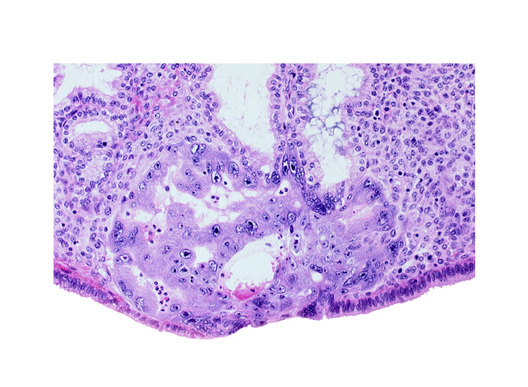 endometrial sinusoid, intercommunicating lacunae, primary umbilical vesicle cavity