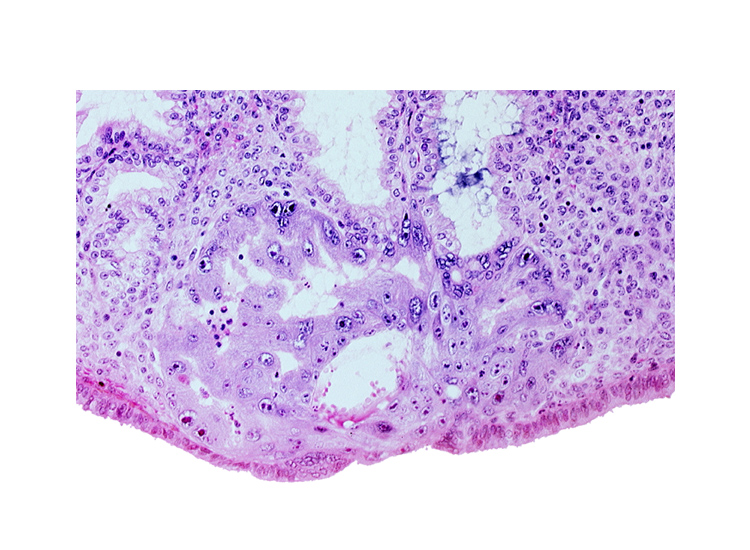 cytotrophoblast, endometrial sinusoid, endometrial stroma (decidua), intercommunicating lacunae, primary umbilical vesicle cavity, syncytiotrophoblast