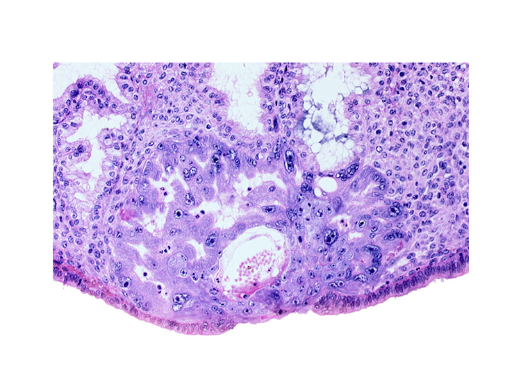 cytotrophoblast, extra-embryonic mesoblast, intercommunicating lacunae, maternal blood cells in primary umbilical vesicle cavity, syncytiotrophoblast