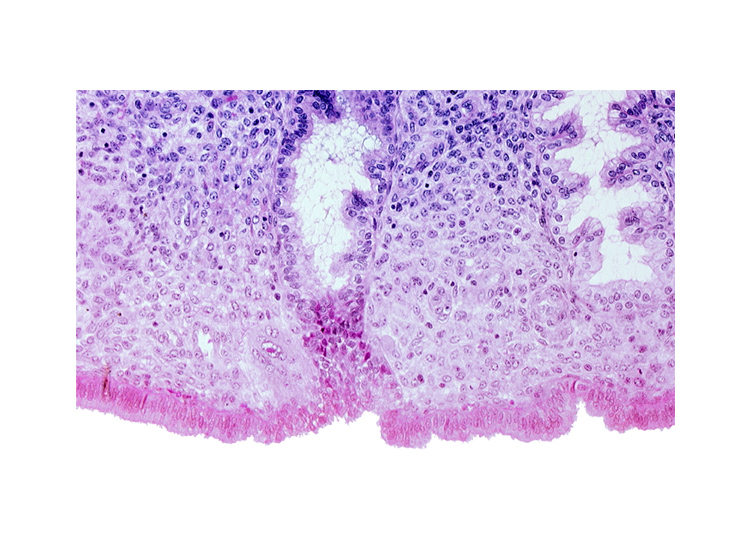 edematous endometrial stroma (decidua), edge of syncytiotrophoblast, intact endometrial epithelium, lumen of endometrial gland