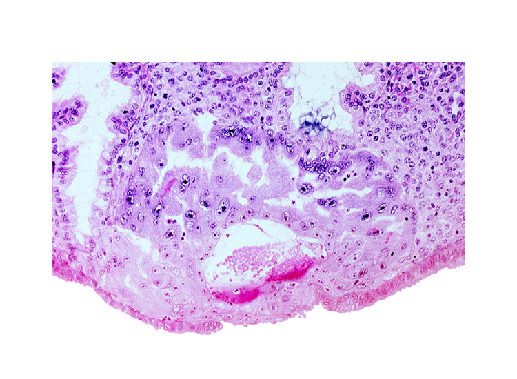 extra-embryonic mesoblast, intercommunicating lacunae, maternal blood cells in primary umbilical vesicle cavity, syncytiotrophoblast