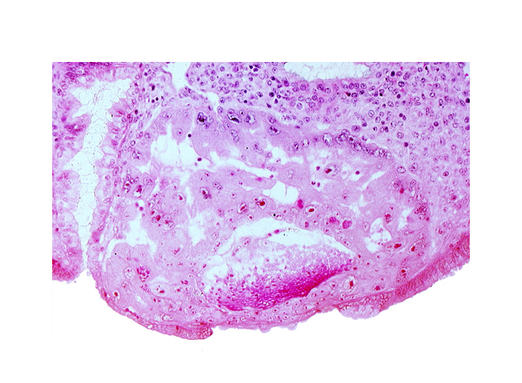 cytotrophoblast, disrupted endometrial epithelium, edge of embryonic disc, extra-embryonic endoblast, intact endometrial epithelium, intercommunicating lacunae, syncytiotrophoblast