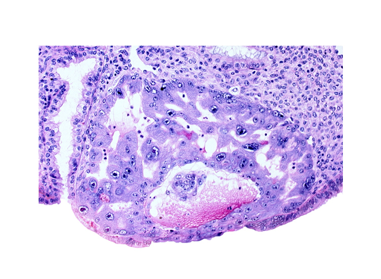 cytotrophoblast, disrupted endometrial epithelium, endometrial epithelium, primary umbilical vesicle cavity, syncytiotrophoblast