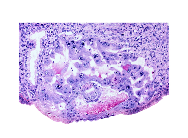 amnioblast(s), cytotrophoblast, edge of amniotic cavity, endometrial sinusoid, epiblast, hypoblast, intercommunicating lacunae, lumen of endometrial gland, syncytiotrophoblast