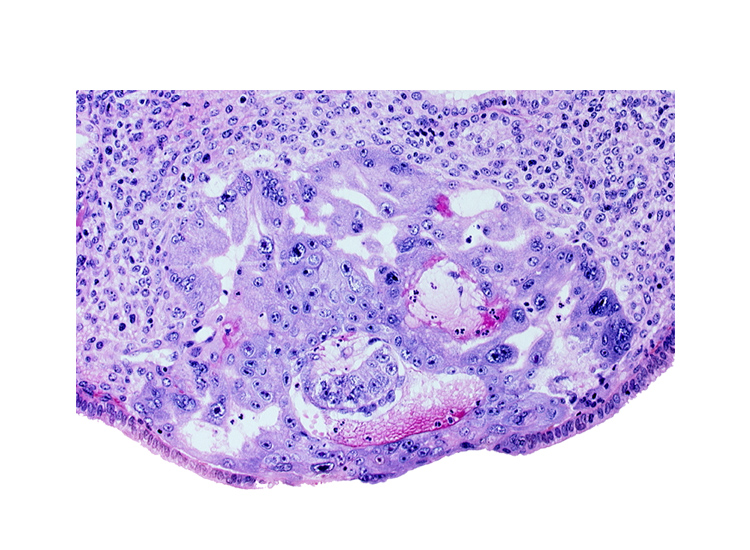 amnioblast(s), embryonic disc, endometrial epithelium, uterine cavity