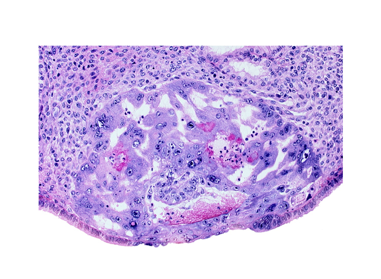 amnioblast(s), disrupted endometrial gland cells, epiblast, extra-embryonic endoblast applied to trophoblast, intact endometrial epithelium, syncytiotrophoblast