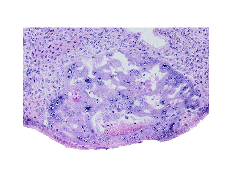 extra-embryonic mesoblast, maternal blood cells in primary umbilical vesicle cavity, primary umbilical vesicle cavity