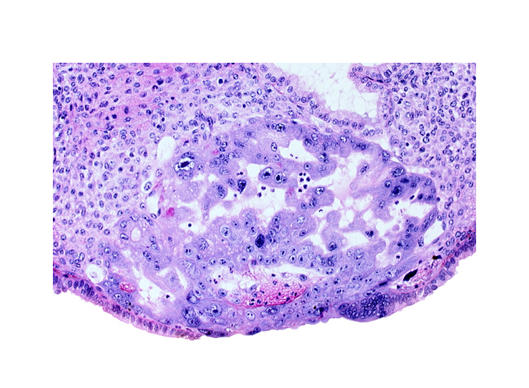 cytotrophoblast, maternal blood cells in primary umbilical vesicle cavity, previllus clump of cytotrophoblast, syncytiotrophoblast