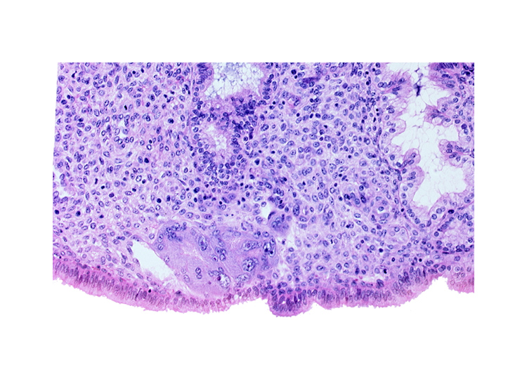 endometrial gland, endometrial sinusoid, intact endometrial epithelium, syncytiotrophoblast, uterine cavity