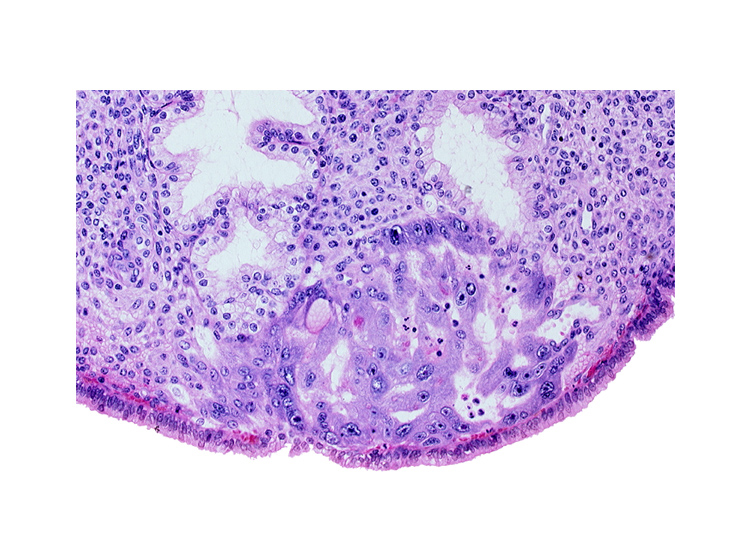 endometrial sinusoid, intact endometrial epithelium, junction of endometrial sinusoid and lacuna, lumen of endometrial gland, syncytiotrophoblast, uterine cavity