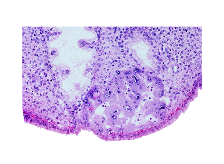 endometrial sinusoid, intact endometrial epithelium, lumen of endometrial gland, maternal blood cells in intercommunicating lacunae, syncytiotrophoblast, uterine cavity