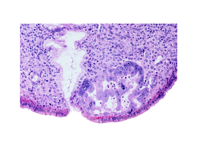 endometrial epithelium, endometrial sinusoid, maternal blood cells in intercommunicating lacunae, mouth of endometrial gland