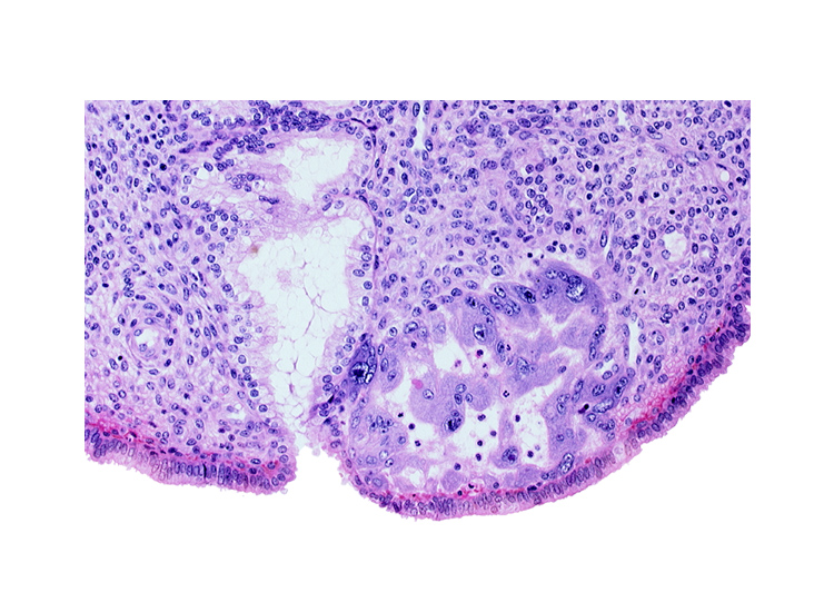 endometrial epithelium, endometrial sinusoid, mouth of endometrial gland