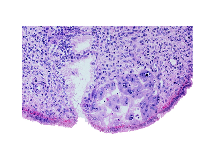 endometrial epithelium, endometrial sinusoid, intercommunicating lacunae, mouth of endometrial gland, syncytiotrophoblast