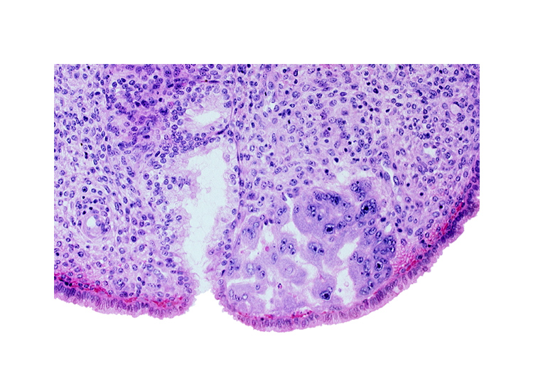 endometrial sinusoid, intact endometrial epithelium, mouth of endometrial gland, uterine cavity