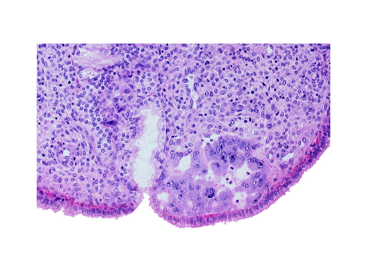 endometrial sinusoid, intact endometrial epithelium, lumen of endometrial gland, mouth of endometrial gland