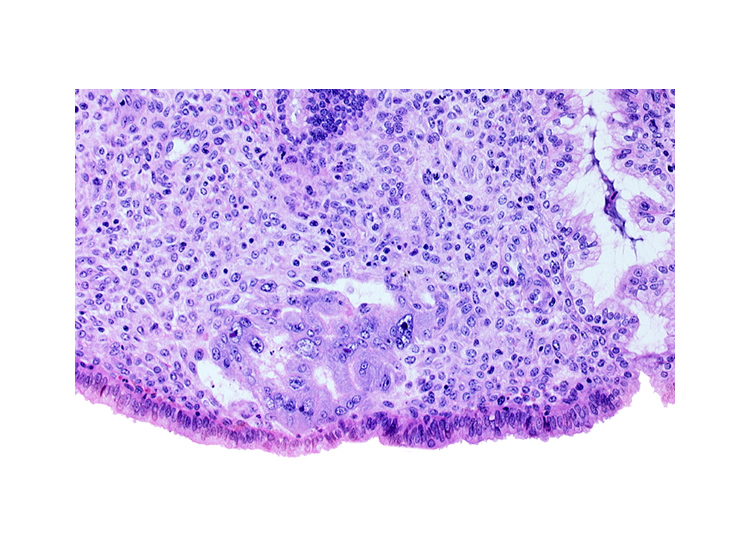 endometrial sinusoid, intact endometrial epithelium, trophoblast lacunae