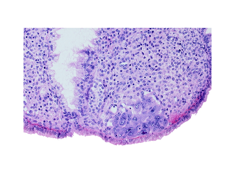 endometrial sinusoid, intact endometrial epithelium, lumen of endometrial gland, syncytiotrophoblast