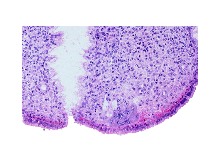 endometrial stroma (decidua), intact endometrial epithelium, lumen of endometrial gland, syncytiotrophoblast