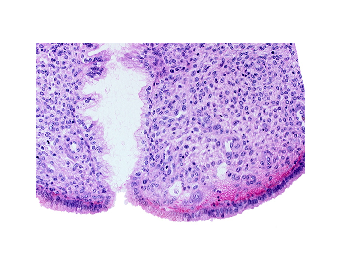 edge of syncytiotrophoblast, endometrial sinusoid, endometrial stroma (decidua), intact endometrial epithelium, lumen of endometrial gland