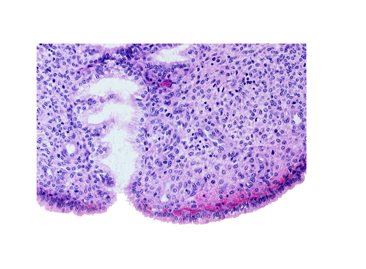 endometrial stroma (decidua), lumen of endometrial gland, mouth of endometrial gland