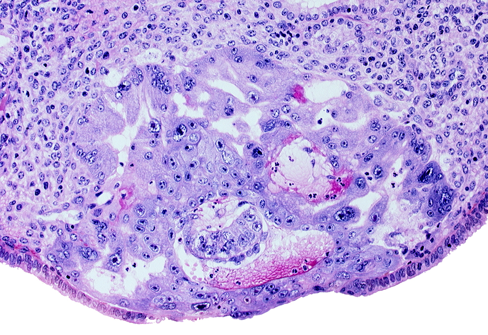 amnioblast(s), embryonic disc, endometrial epithelium, uterine cavity