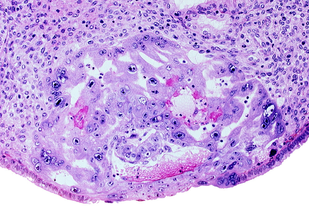 amnioblast(s), embryonic disc, endometrial epithelium, uterine cavity