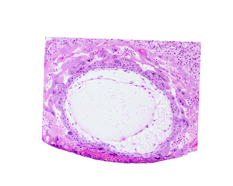 chorionic cavity, primary umbilical vesicle cavity, syncytiotrophoblast