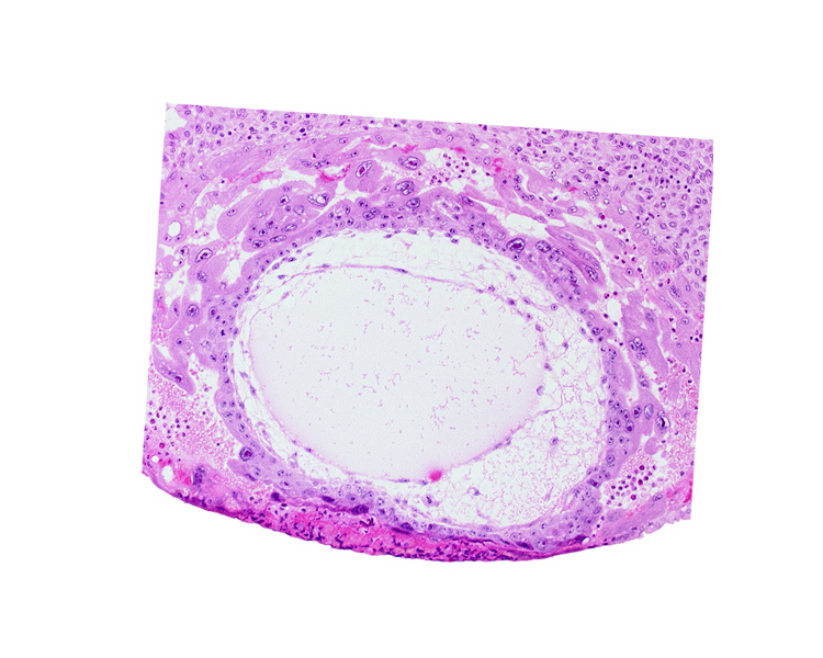 chorionic cavity, definitive exocoelomic (Heuser's) membrane, primary umbilical vesicle cavity