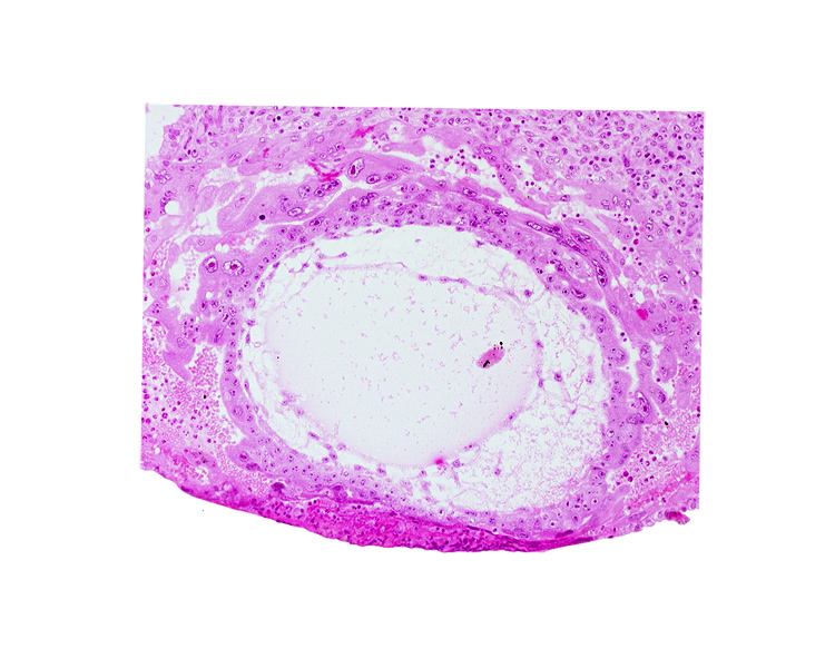 chorionic cavity, definitive exocoelomic (Heuser's) membrane, extra-embryonic mesoblast, primary umbilical vesicle cavity