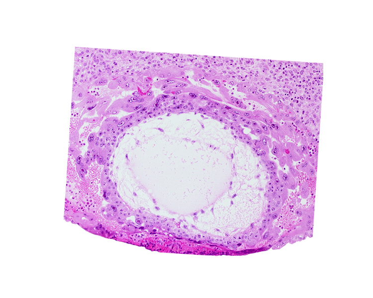 definitive exocoelomic (Heuser's) membrane, extra-embryonic mesoblast, primary umbilical vesicle cavity