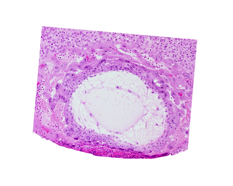 chorionic cavity, definitive exocoelomic (Heuser's) membrane, primary umbilical vesicle cavity