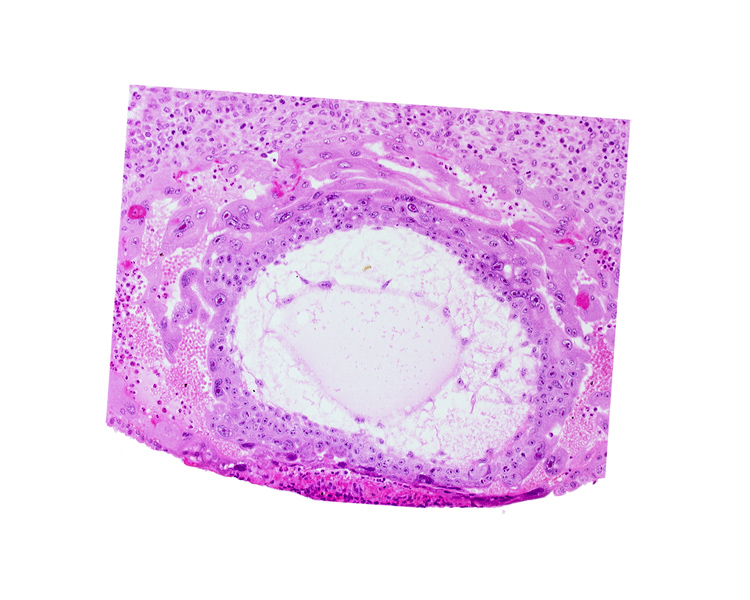 chorionic cavity, definitive exocoelomic (Heuser's) membrane, extra-embryonic mesoblast, syncytiotrophoblast, uterine cavity