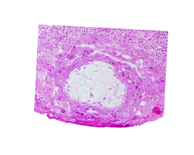 extra-embryonic mesoblast, extra-embryonic reticulum, fibrous coagulum, uterine cavity