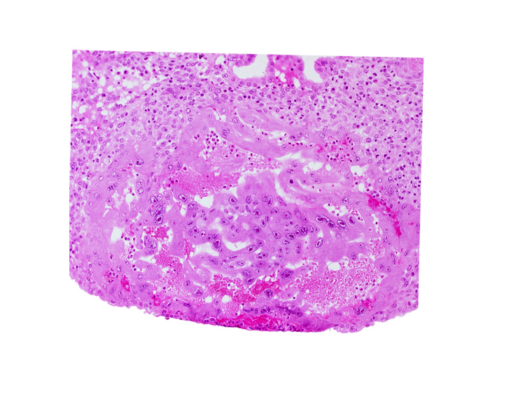 endometrial epithelium, syncytiotrophoblast, uterine cavity