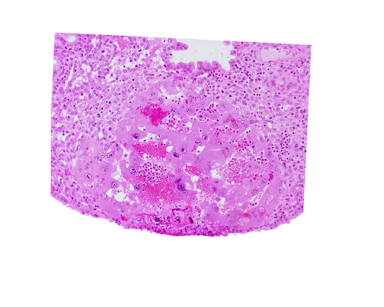 endometrial epithelium, lacunar vascular circle, lumen of endometrial gland, maternal blood cells in trophoblast lacuna, uterine cavity