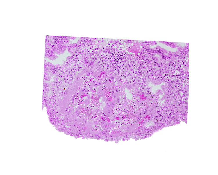 endometrial epithelium, syncytiotrophoblast, uterine cavity