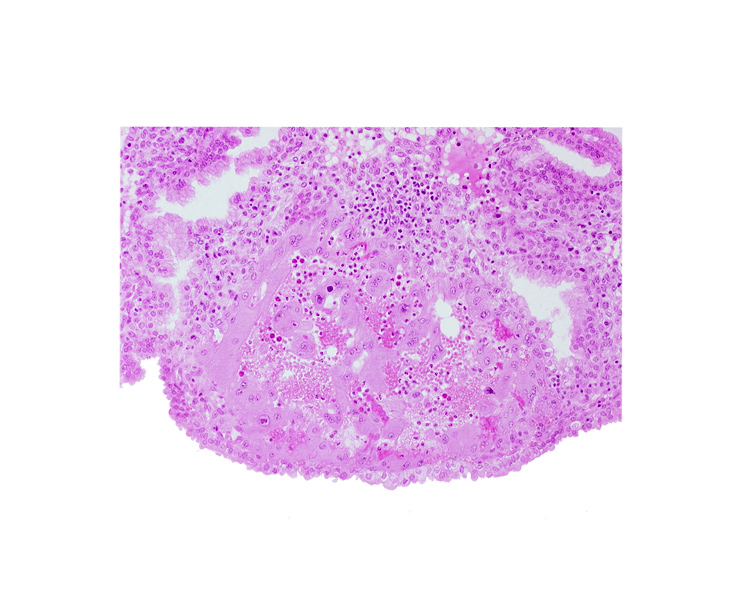 endometrial epithelium, maternal blood cells in trophoblast lacuna, syncytiotrophoblast, uterine cavity