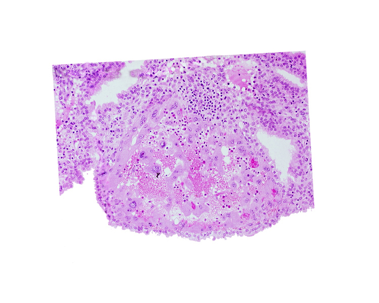 endometrial epithelium, maternal blood cells in trophoblast lacuna, syncytiotrophoblast, syncytiotrophoblast / decidua interface, uterine cavity