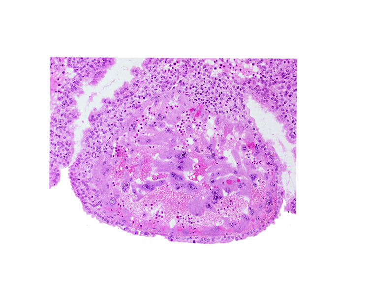 endometrial epithelium, maternal blood cells in trophoblast lacuna, mouth of endometrial gland, syncytiotrophoblast