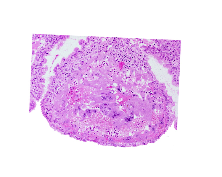 endometrial epithelium, intercommunicating lacunae, interrupted endometrial epithelium, maternal blood cells in trophoblast lacuna, mouth of endometrial gland, syncytiotrophoblast