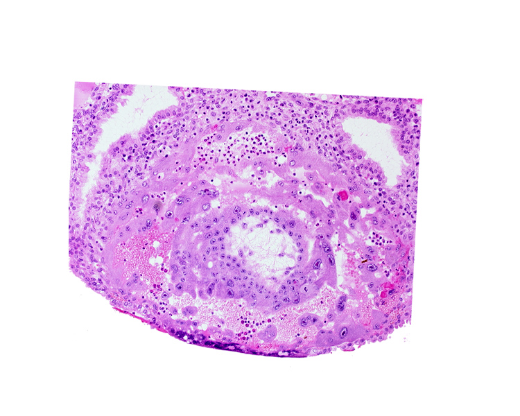 chorionic cavity, disrupted endometrial epithelium, lacunar vascular circle, syncytiotrophoblast, uterine cavity