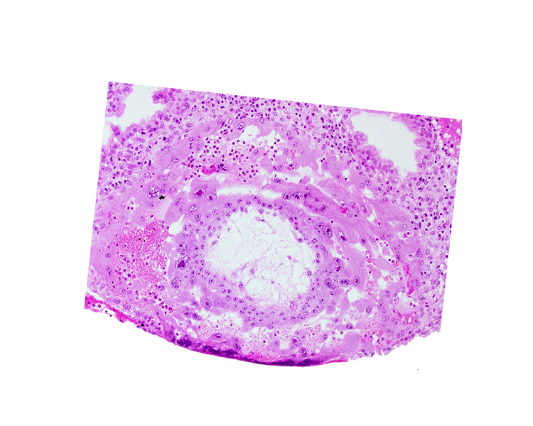 chorion, disrupted endometrial epithelium, extra-embryonic reticulum, lacunar vascular circle, syncytiotrophoblast, uterine cavity