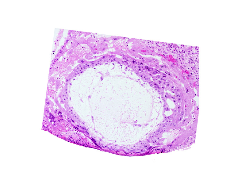 chorionic cavity, cytotrophoblast, extra-embryonic mesoblast, primary umbilical vesicle cavity, uterine cavity