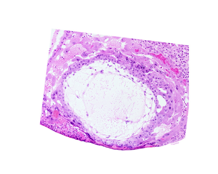 chorionic cavity, primary umbilical vesicle cavity, uterine cavity