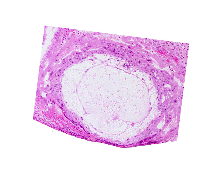 edge of embryonic disc, exocoelomic (Heuser's) membrane, lacunar vascular circle, trophoblast lacunae