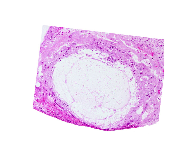 chorionic cavity, extra-embryonic mesoblast, primary umbilical vesicle cavity, uterine cavity